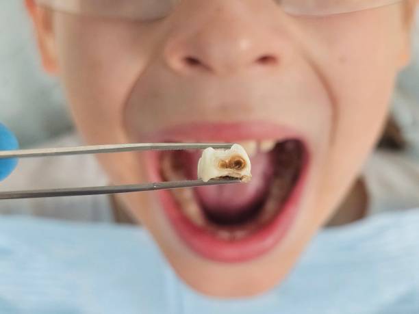Best Holiday Emergency Dentist in Cross Roads, TX